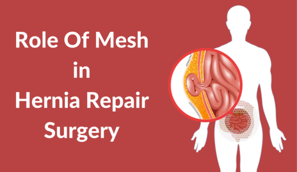 Role Of Mesh In Hernia Repair Surgery