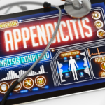 appendix surgery