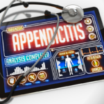 complete guide on appendix surgery-facebook