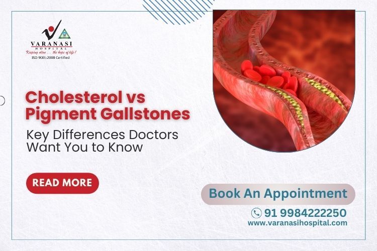 Cholesterol vs Pigment Gallstones