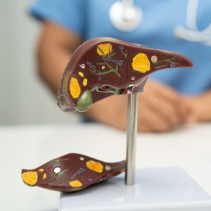 Early Warning Signs of Gallstones