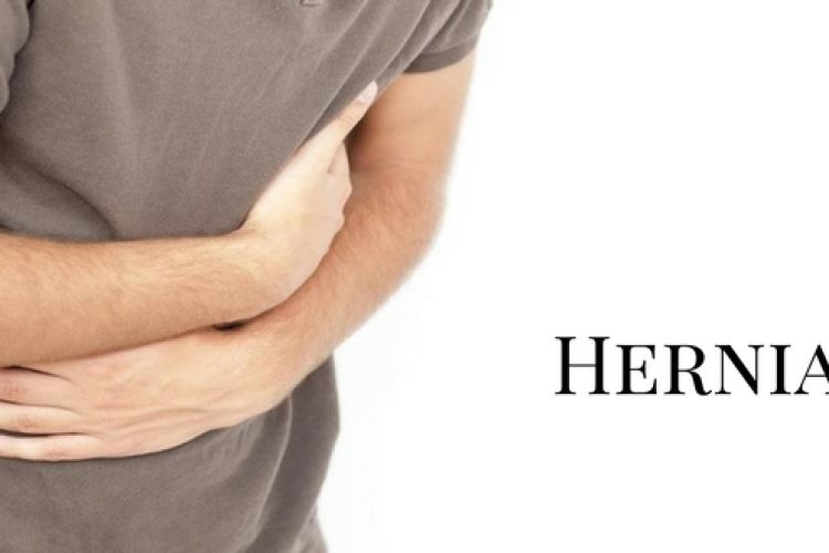 Let Us Get To Know Some Common Facts About A Hernia