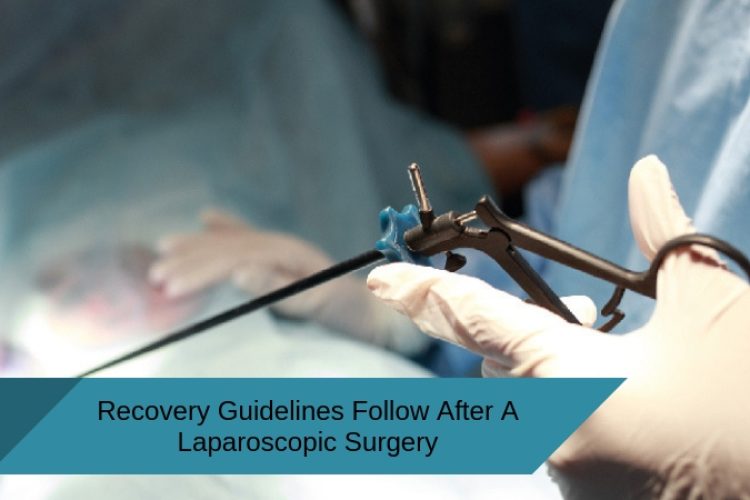 Recovery Guidelines to follow after a Laparoscopic Surgery