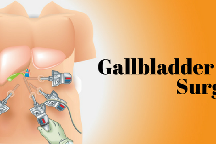 Things You Should Know If Your Gallbladder Is Removed!